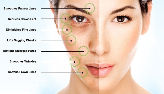 EINECS 232-678-0 Bubuk Asam Hyaluronic 2000- 5000 Dalton Serbuk Serum Asam Hyaluronic Murni